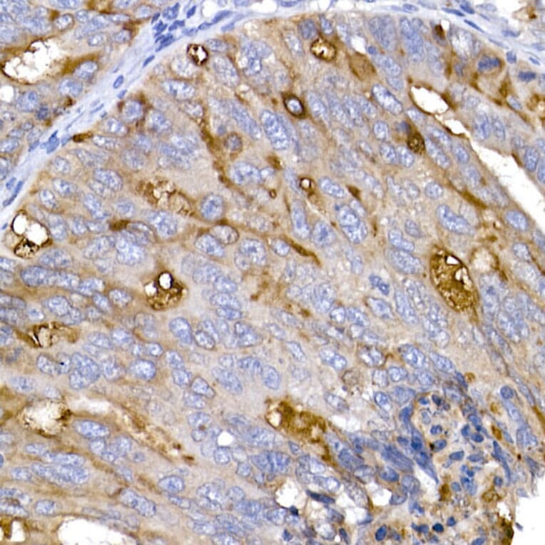 Immunohistochemistry - Anti-ACE2 Antibody (A87864) - Antibodies.com