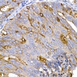 Immunohistochemistry - Anti-ACE2 Antibody (A87864) - Antibodies.com