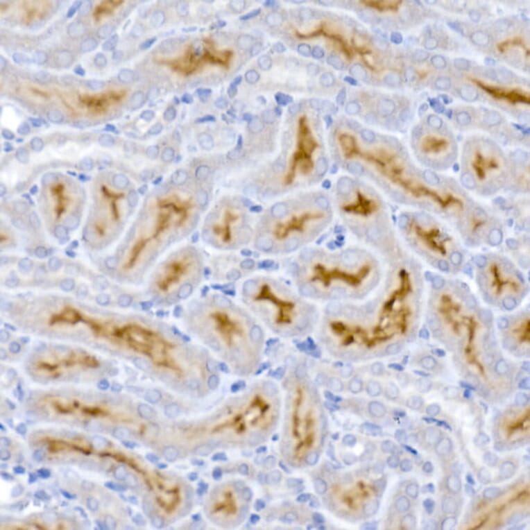 Immunohistochemistry - Anti-ACE2 Antibody (A87864) - Antibodies.com