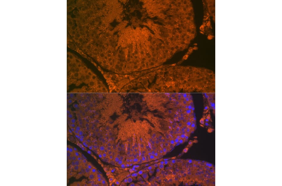 Immunofluorescence - Anti-ACE2 Antibody (A87864) - Antibodies.com