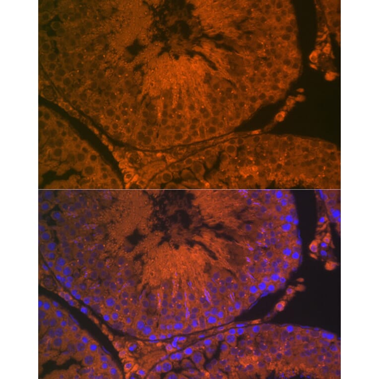 Immunofluorescence - Anti-ACE2 Antibody (A87864) - Antibodies.com