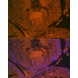 Immunofluorescence - Anti-ACE2 Antibody (A87864) - Antibodies.com