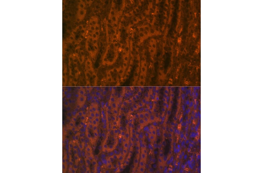 Immunofluorescence - Anti-ACE2 Antibody (A87864) - Antibodies.com