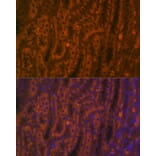 Immunofluorescence - Anti-ACE2 Antibody (A87864) - Antibodies.com
