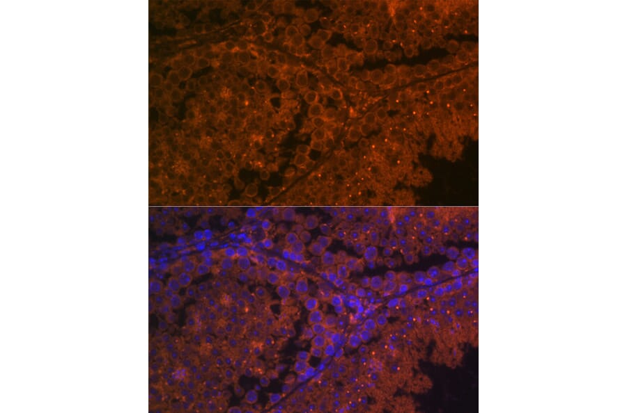 Immunofluorescence - Anti-ACE2 Antibody (A87864) - Antibodies.com