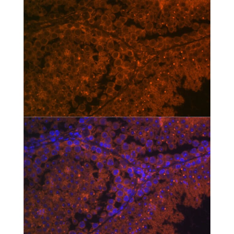 Immunofluorescence - Anti-ACE2 Antibody (A87864) - Antibodies.com