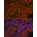 Immunofluorescence - Anti-ACE2 Antibody (A87864) - Antibodies.com