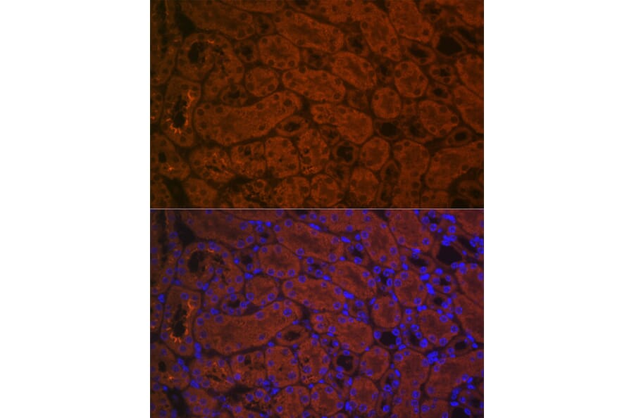 Immunofluorescence - Anti-ACE2 Antibody (A87864) - Antibodies.com