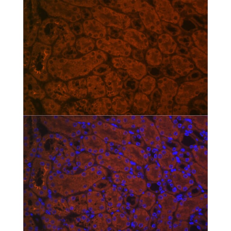 Immunofluorescence - Anti-ACE2 Antibody (A87864) - Antibodies.com