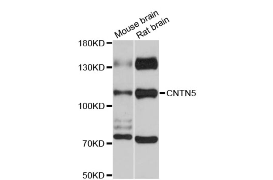 Western Blot - Anti-CNTN5 Antibody (A12655) - Antibodies.com