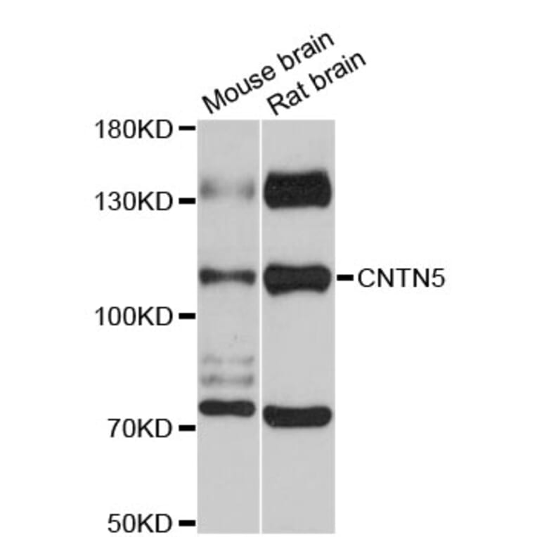 Western Blot - Anti-CNTN5 Antibody (A12655) - Antibodies.com