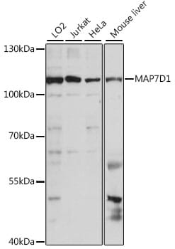 Western blot analysis of extracts of various cell lines, using Anti-MAP7D1 Antibody (A15862) at 1:1,000 dilution.
Secondary antibody: Goat Anti-Rabbit IgG (H+L) (HRP) (AS014) at 1:10,000 dilution.
Lysates / proteins: 25µg per lane.
Blocking buffer: 3% non-fat dry milk in TBST.
Detection: ECL Basic Kit (RM00020).
Exposure time: 10s.