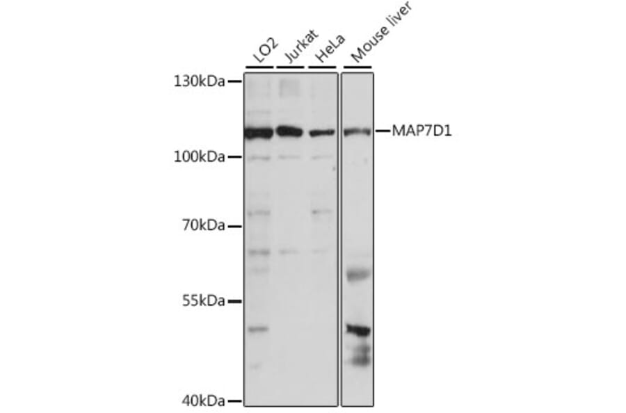 Western Blot - Anti-MAP7D1 Antibody (A87866) - Antibodies.com