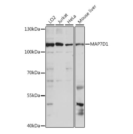 Western Blot - Anti-MAP7D1 Antibody (A87866) - Antibodies.com