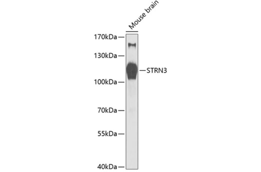 Western Blot - Anti-STRN3 Antibody (A87867) - Antibodies.com