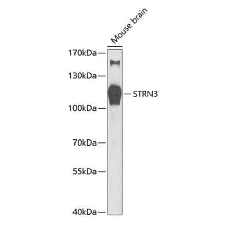 Western Blot - Anti-STRN3 Antibody (A87867) - Antibodies.com