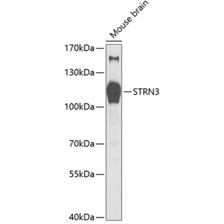 Western Blot - Anti-STRN3 Antibody (A87867) - Antibodies.com