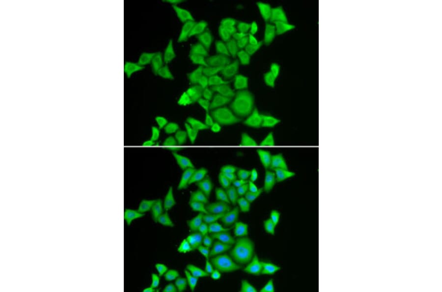 Immunofluorescence - Anti-STRN3 Antibody (A87867) - Antibodies.com