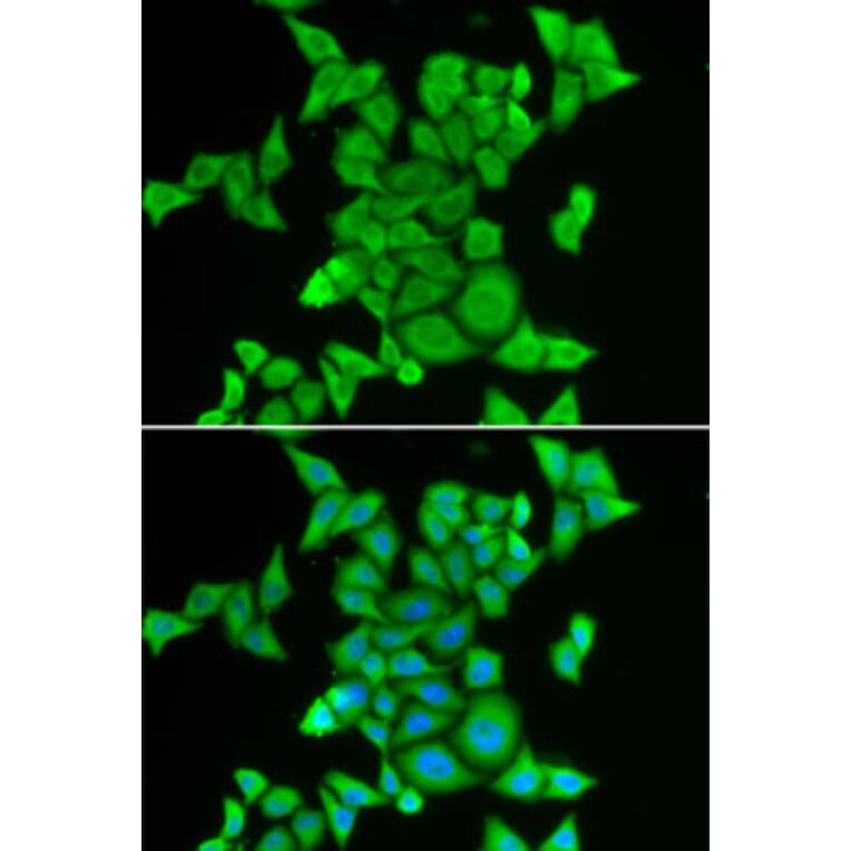 Immunofluorescence - Anti-STRN3 Antibody (A87867) - Antibodies.com