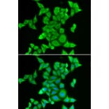 Immunofluorescence - Anti-STRN3 Antibody (A87867) - Antibodies.com