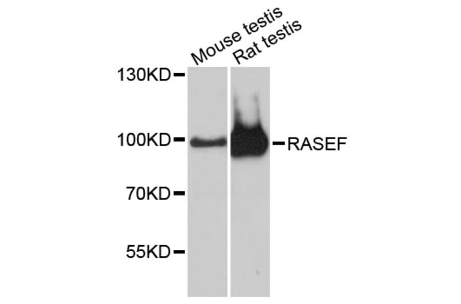 Western Blot - Anti-RASEF Antibody (A13877) - Antibodies.com