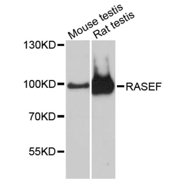 Western Blot - Anti-RASEF Antibody (A13877) - Antibodies.com