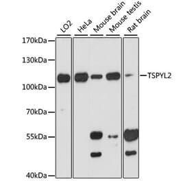 Western Blot - Anti-DENTT Antibody (A87869) - Antibodies.com