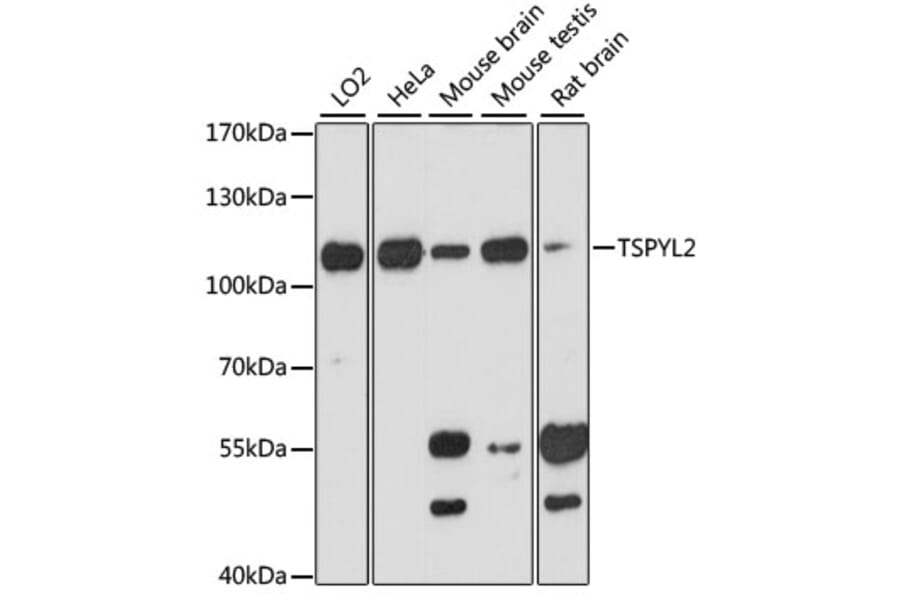 Western Blot - Anti-DENTT Antibody (A87869) - Antibodies.com