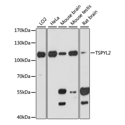 Western Blot - Anti-DENTT Antibody (A87869) - Antibodies.com