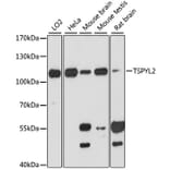 Western Blot - Anti-DENTT Antibody (A87869) - Antibodies.com