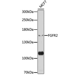 Western Blot - Anti-FGFR2 Antibody (A87870) - Antibodies.com