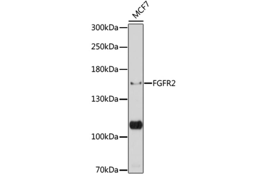 Western Blot - Anti-FGFR2 Antibody (A87870) - Antibodies.com