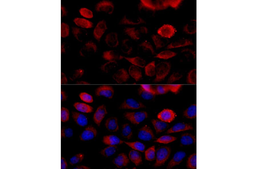 Immunofluorescence - Anti-FGFR2 Antibody (A87870) - Antibodies.com
