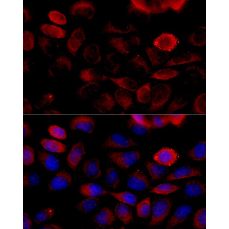 Immunofluorescence - Anti-FGFR2 Antibody (A87870) - Antibodies.com