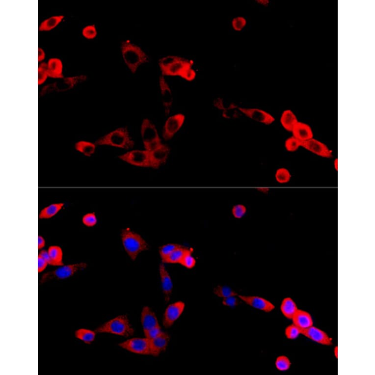 Immunofluorescence - Anti-FGFR2 Antibody (A87870) - Antibodies.com