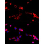 Immunofluorescence - Anti-FGFR2 Antibody (A87870) - Antibodies.com