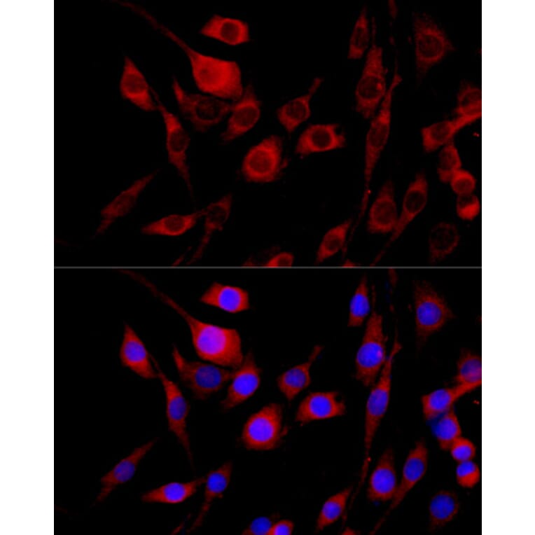 Immunofluorescence - Anti-FGFR2 Antibody (A87870) - Antibodies.com