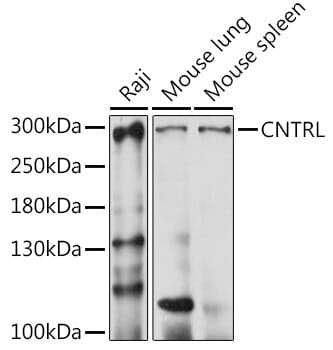 Western blot analysis of extracts of various cell lines, using Anti-CNTRL Antibody (A15138) at 1:1,000 dilution.
Secondary antibody: Goat Anti-Rabbit IgG (H+L) (HRP) (AS014) at 1:10,000 dilution.
Lysates / proteins: 25µg per lane.
Blocking buffer: 3% non-fat dry milk in TBST.
Detection: ECL Basic Kit (RM00020).
Exposure time: 5s.