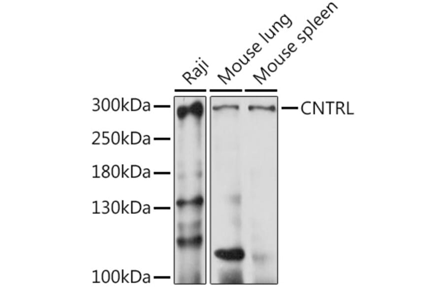 Western Blot - Anti-CNTRL Antibody (A87872) - Antibodies.com