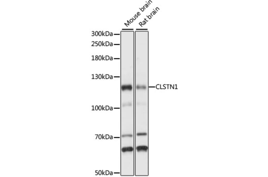 Western Blot - Anti-CLSTN1 Antibody (A87873) - Antibodies.com