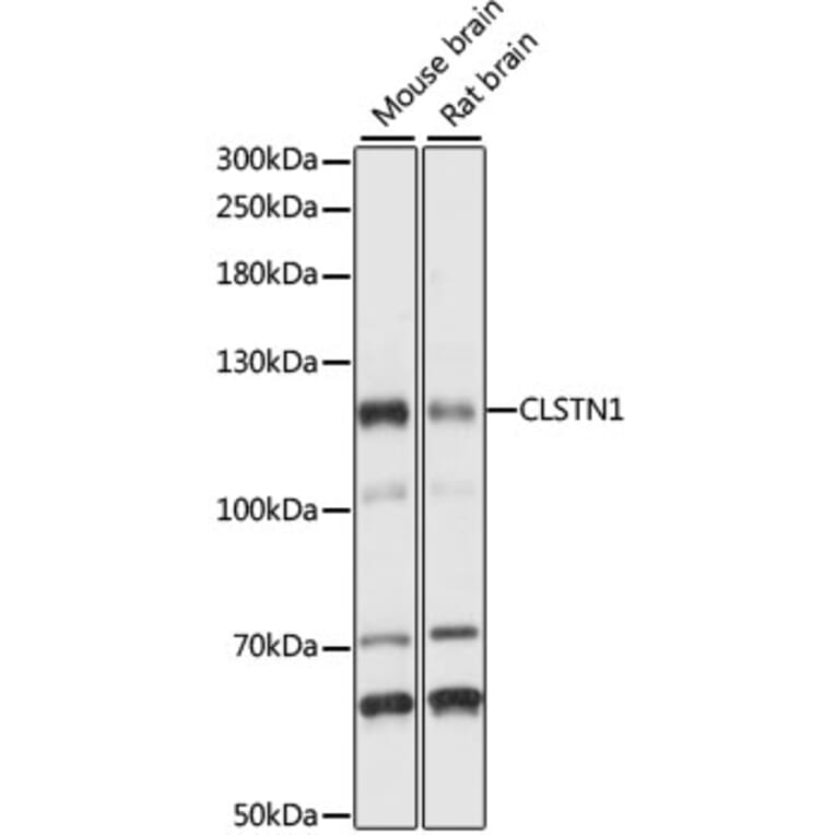 Western Blot - Anti-CLSTN1 Antibody (A87873) - Antibodies.com