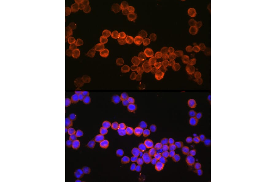 Immunofluorescence - Anti-CD36 Antibody (A87874) - Antibodies.com