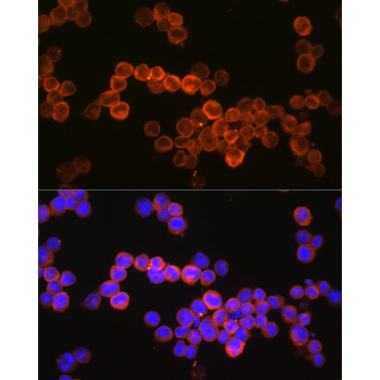 Immunofluorescence - Anti-CD36 Antibody (A87874) - Antibodies.com