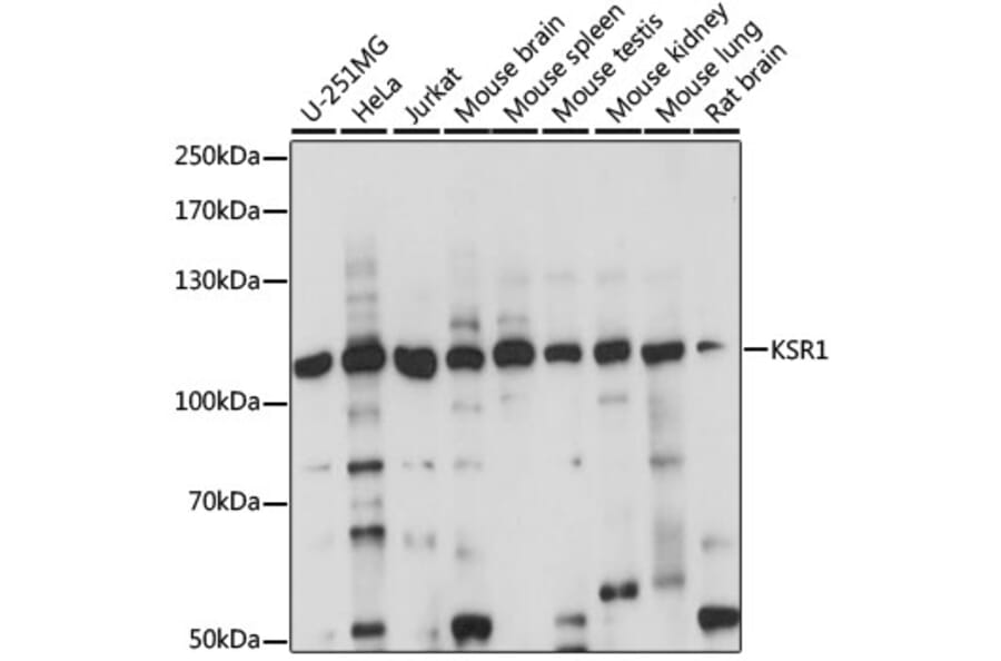 Western Blot - Anti-KSR1 Antibody (A87875) - Antibodies.com