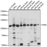 Western Blot - Anti-KSR1 Antibody (A87875) - Antibodies.com