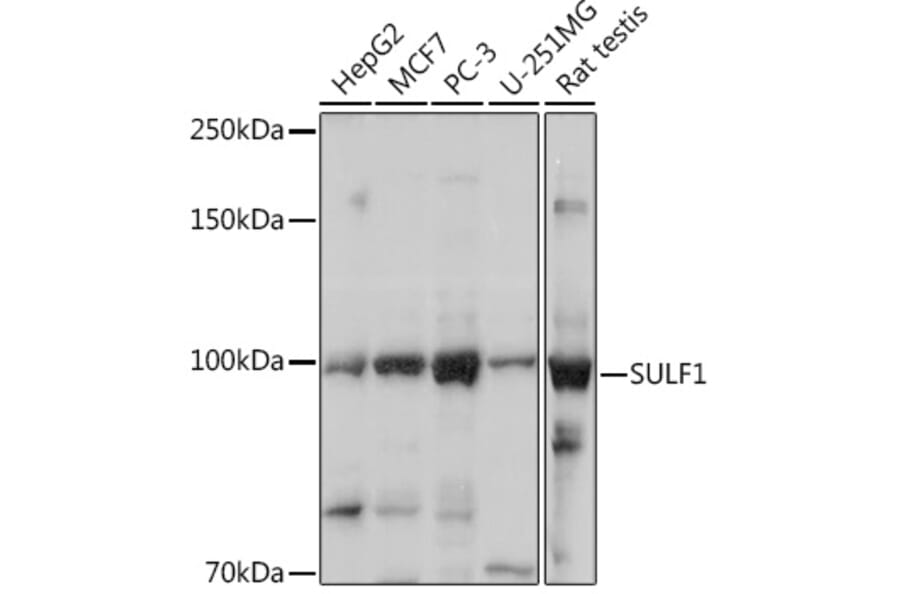 Western Blot - Anti-Sulfatase 1/SULF1 Antibody (A87876) - Antibodies.com
