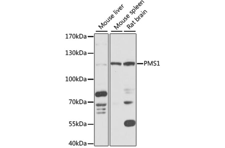 Western Blot - Anti-PMS1 Antibody (A87877) - Antibodies.com