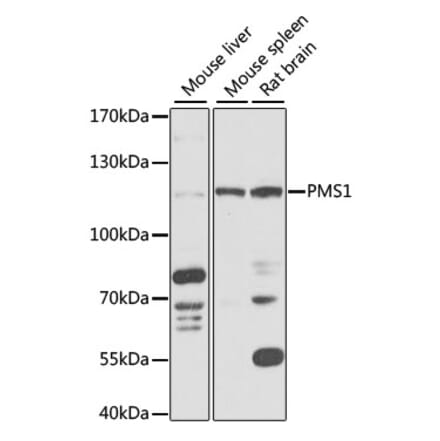 Western Blot - Anti-PMS1 Antibody (A87877) - Antibodies.com