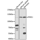 Western Blot - Anti-PMS1 Antibody (A87877) - Antibodies.com