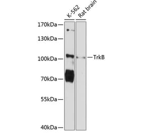 Western Blot - Anti-TrkB Antibody (A87878) - Antibodies.com